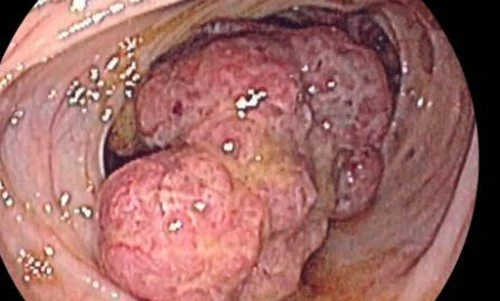 Thủ phạm khiến 6 triệu người tử vong mỗi năm ảnh 1