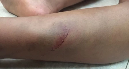 bé trai; bị bạo hành; đánh đập; Lục Ngạn; Bắc Giang