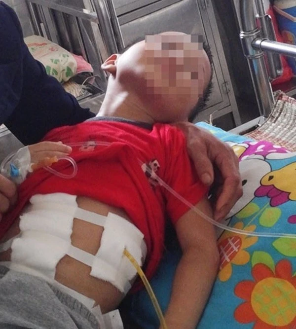 Bé trai 5 tuổi bị đánh vỡ gan, gãy xương sườn ảnh 2