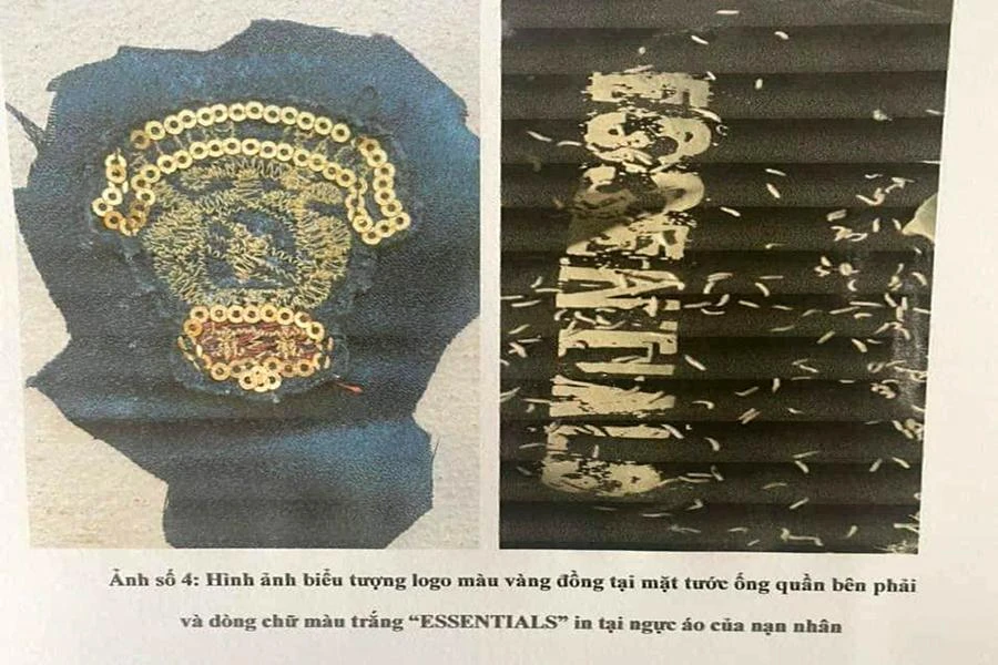 Áo và mặt trước ống quần của nạn nhân. Ảnh: Công an cung cấp