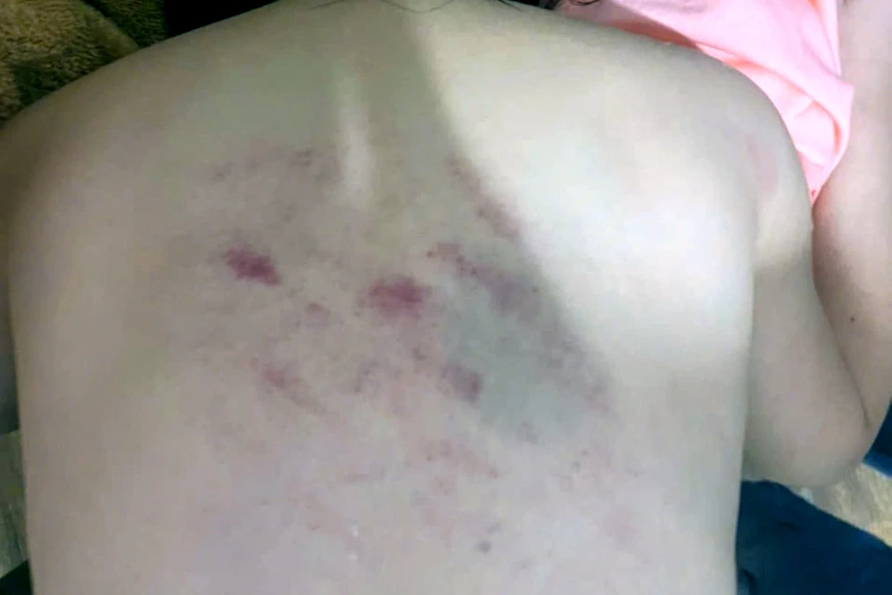 Thanh Hóa Đình chỉ công tác cô giáo có hành vi bạo lực với học sinh - 2.jpg