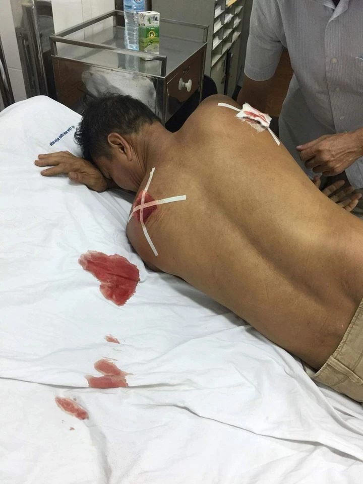 Ông Lưu khi được đưa vào bệnh viện