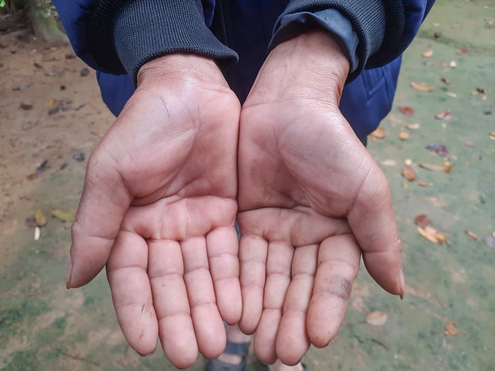 Bàn tay chai sạn của ông Hồ Phình. Ảnh: B.T