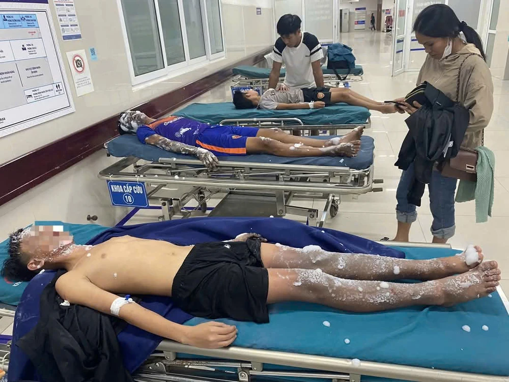 Chế pháo nổ theo 'công thức' trên mạng, 4 học sinh bị bỏng nặng