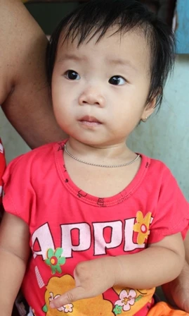 Bé Tiên sinh ra tứ chi chỉ 1 ngón giống cha, ông của mình