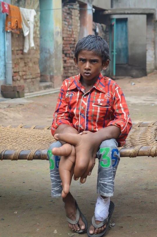 Cậu bé có đôi bàn tay khổng lồ ảnh 7