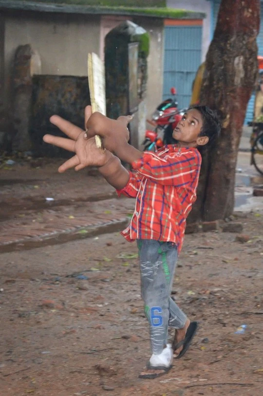 Nhiều khả năng&nbsp;cậu bé đã mắc bệnh u mạch bạch huyết hoặc bệnh u mô thừa