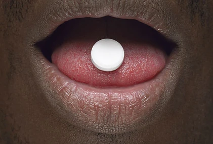 Nhìn răng miệng, chẩn bệnh ảnh 2