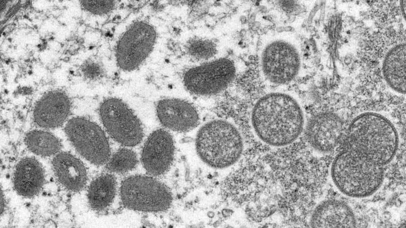 Các phần tử virus gây bệnh đậu mùa khỉ từ mẫu da người. Ảnh: AFP