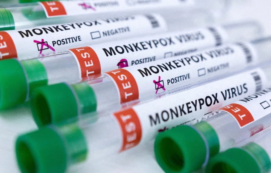 Kit test đậu mùa khỉ. ẢNH: REUTERS