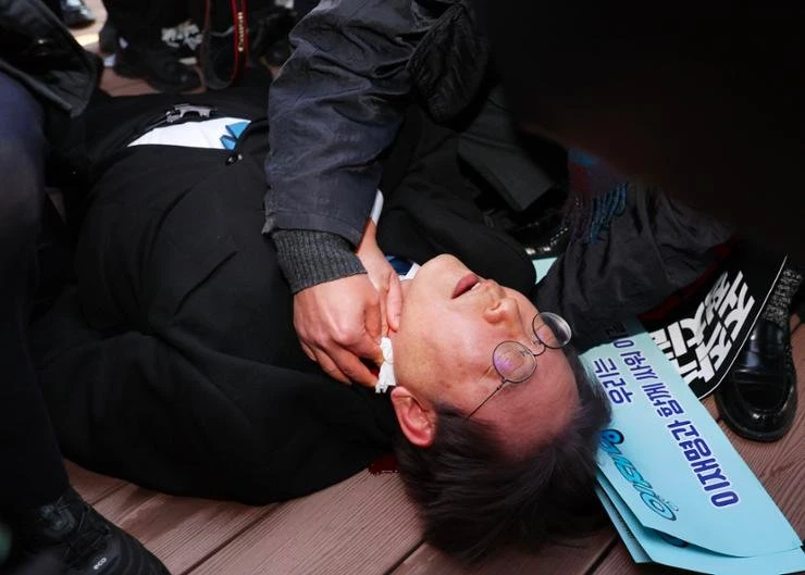 nghị sĩ bị tấn công.jpeg