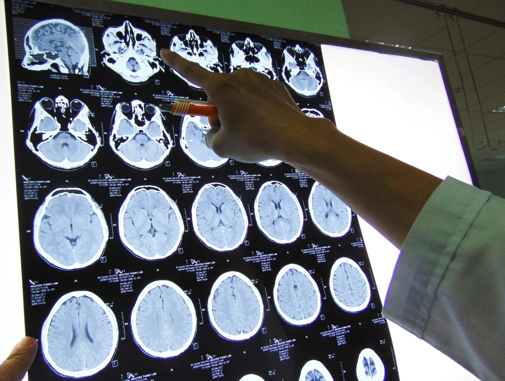 Tấm thép rơi cắt gần đứt mũi và cẳng chân một thợ hồ ảnh 2