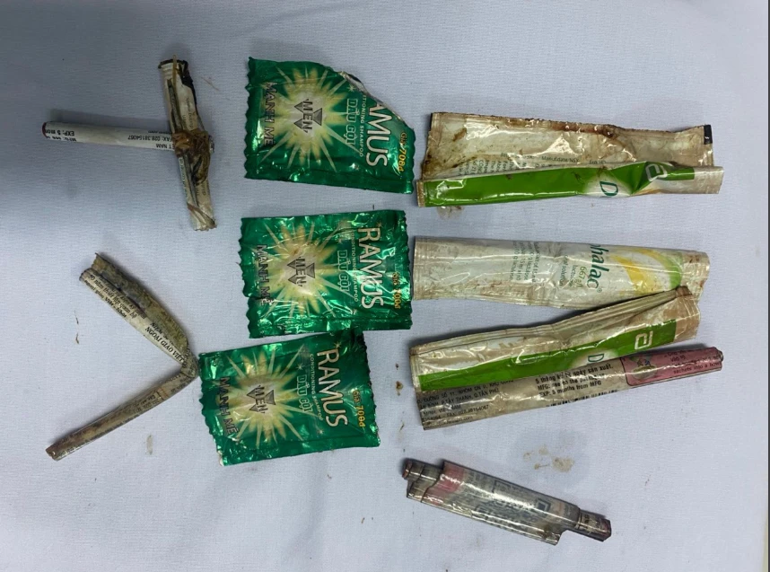 Vỏ dầu gội cuốn tròn và đinh bọc túi nhựa được nội soi lấy ra. Ảnh: BVCC