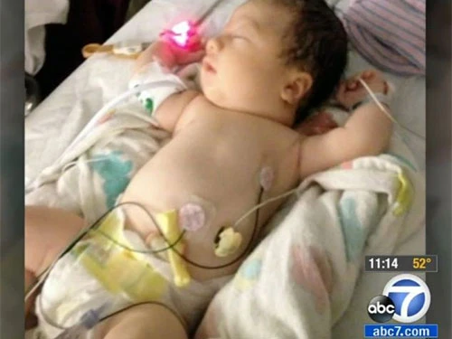 Bé gái sinh ra không có máu