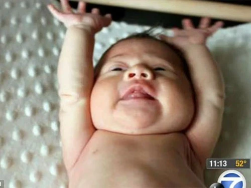 Bé gái sinh ra không có máu