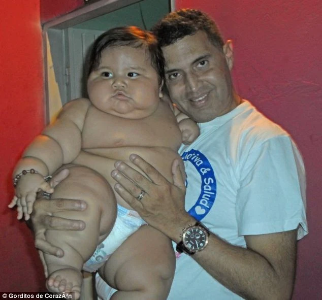 Bé trai béo nhất Colombia được điều trị giảm cân ảnh 2