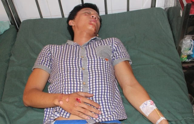 Nghi ngờ CSTT dùng gậy đánh người vi phạm giao thông ảnh 1 Nghi ngờ CSTT dùng gậy đánh người vi phạm giao thông ảnh 1