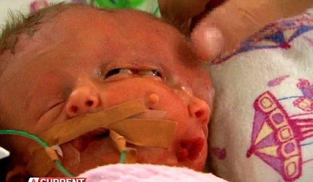 Hai bé ra đời sớm hơn 6 tuần so với dự kiến.