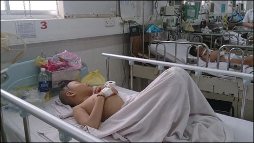 Ăn ốc ma, bé trai chín tuổi nhập viện ảnh 1 Ăn ốc ma, bé trai chín tuổi nhập viện ảnh 1