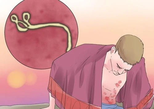 Ebola, virus Ebola, đại dịch Ebola, phòng và điều trị Ebola, biến chứng nguy hiểm của Ebola