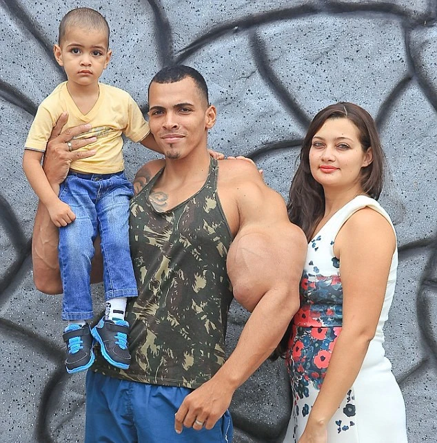 Vận động viên thể hình liều mạng để có cơ bắp giống Hulk ảnh 2