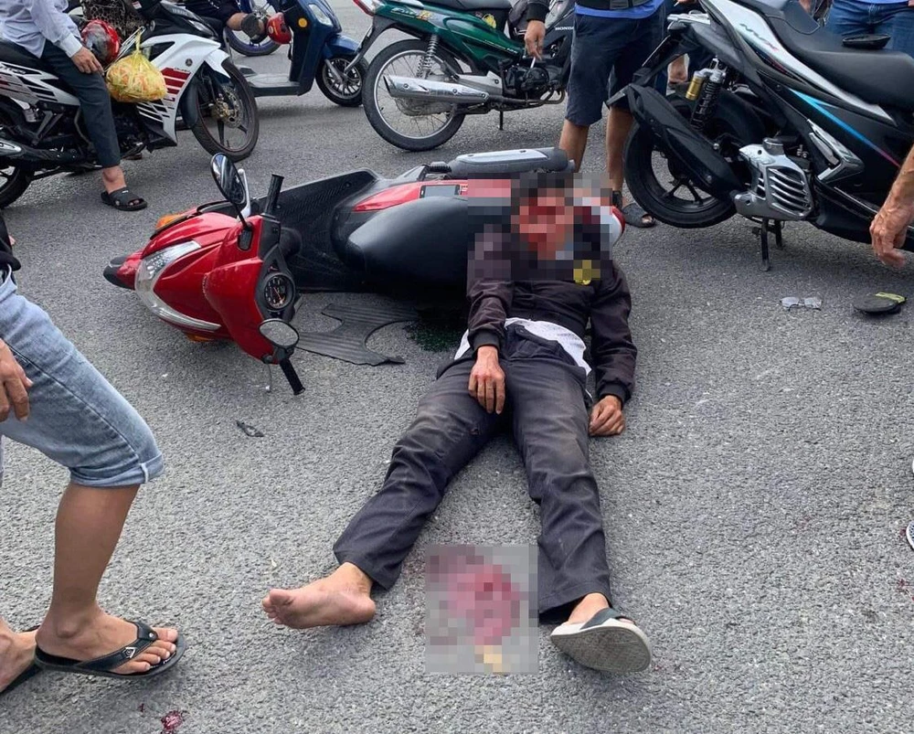 Tên trộm bị tai nạn rất nặng khi lấy xe máy bỏ chạy gây tai nạn. Ảnh: HD