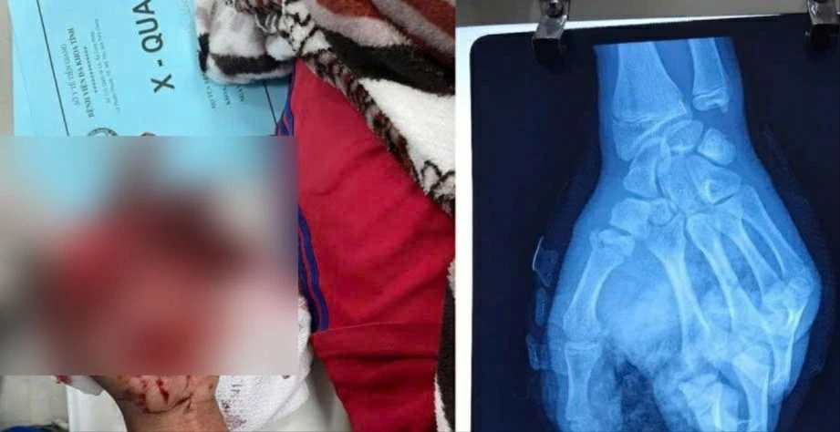 bé trai 14 tuổi.jpg