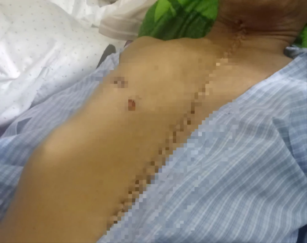 Tranh chấp đất.jpg