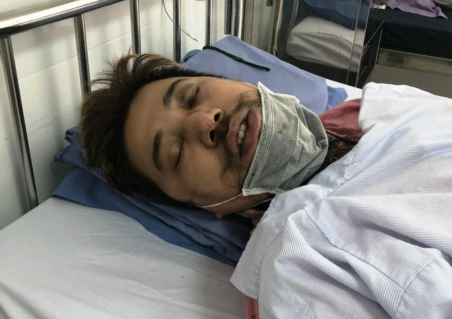 Ông Duy bị vỡ xương mũi đang điều trị tại bệnh viện. Ảnh: H.H