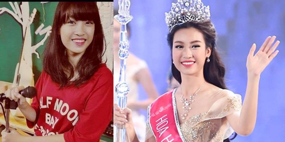 Tân hoa hậu bị tố phẫu thuật thẩm mỹ răng, ban tổ chức nói gì? ảnh 3