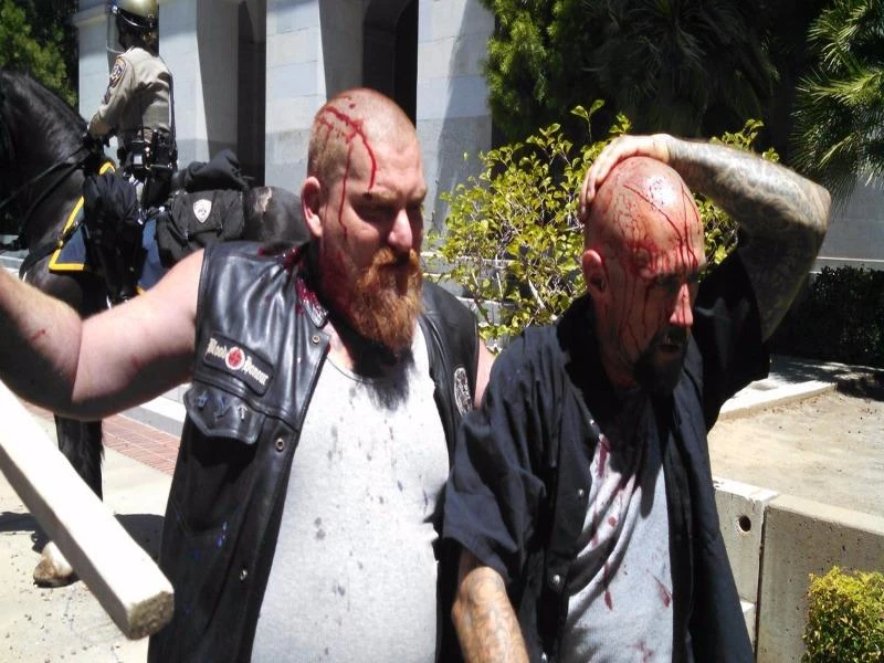 Bị thương trong xung đột biểu tình