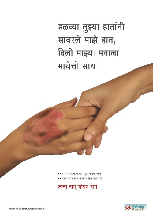 Hiến da là nghĩa cử rất cao thượng trong y khoa, đặc biệt đối với các bệnh nhân bị bỏng.