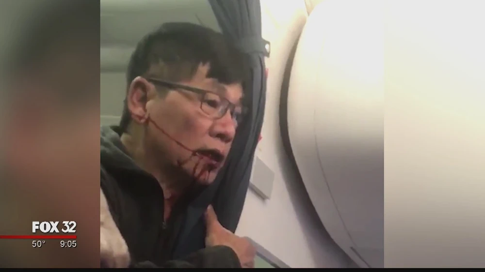 Ông David Dao bị thương trong khi bị kéo lê khỏi máy bay của United Airlines tối 9-4. Ảnh: FOX 32