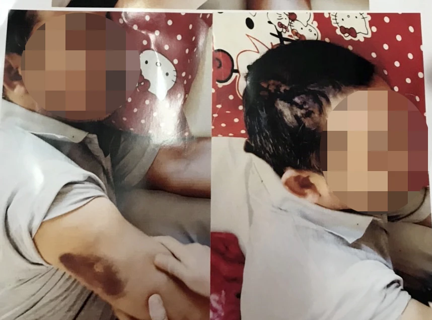 Hình ảnh ông Cường cho rằng bị hại Vinh có hai vết thương ở đầu và cánh tay phải. Ảnh: GĐCC