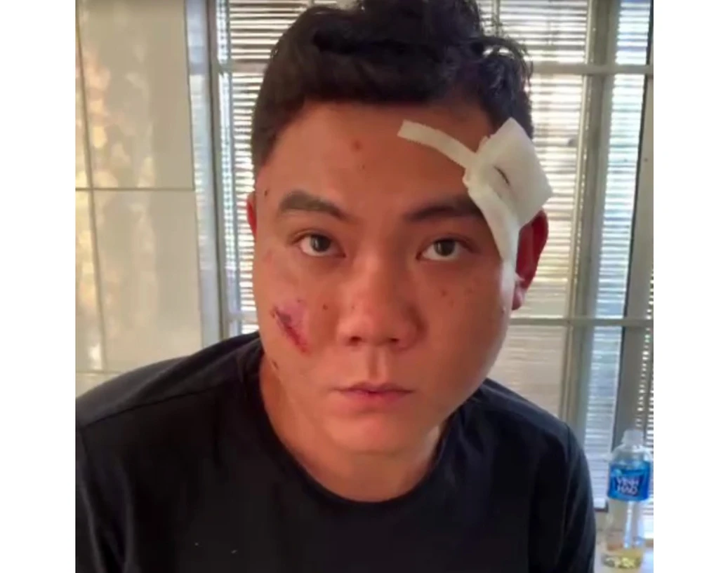 Phan Thành Dũng, nghi phạm gây ra vụ nổ súng. Ảnh: C.A