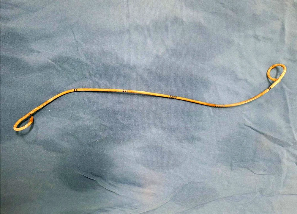 ong thong nieu quan.jpg