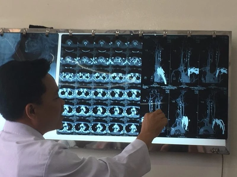 Nếu không được mổ kịp thời bệnh nhân đã tử vong do vỡ mạch máu