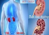 Dấu hiệu nhận biết suy thận