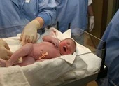 Sinh con tại nhà: 10/100 bé sơ sinh chào đời không tự thở được