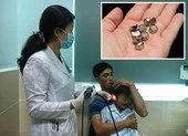 Cảnh báo trẻ bị thủng mũi, màng nhĩ từ pin đồ chơi
