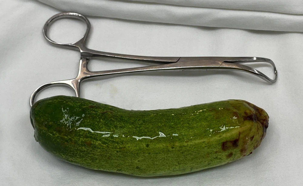 Dị vật là quả dưa leo được lấy ra từ hậu môn của nam thanh niên. Ảnh: BSCC Dị vật là quả dưa leo được lấy ra từ hậu môn của nam thanh niên. Ảnh: BSCC