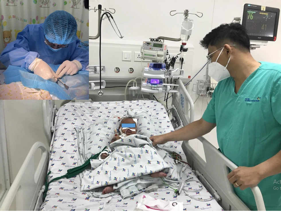 Bé gái điều trị tại Bệnh viện Nhi đồng Thành phố. Ảnh: BVCC