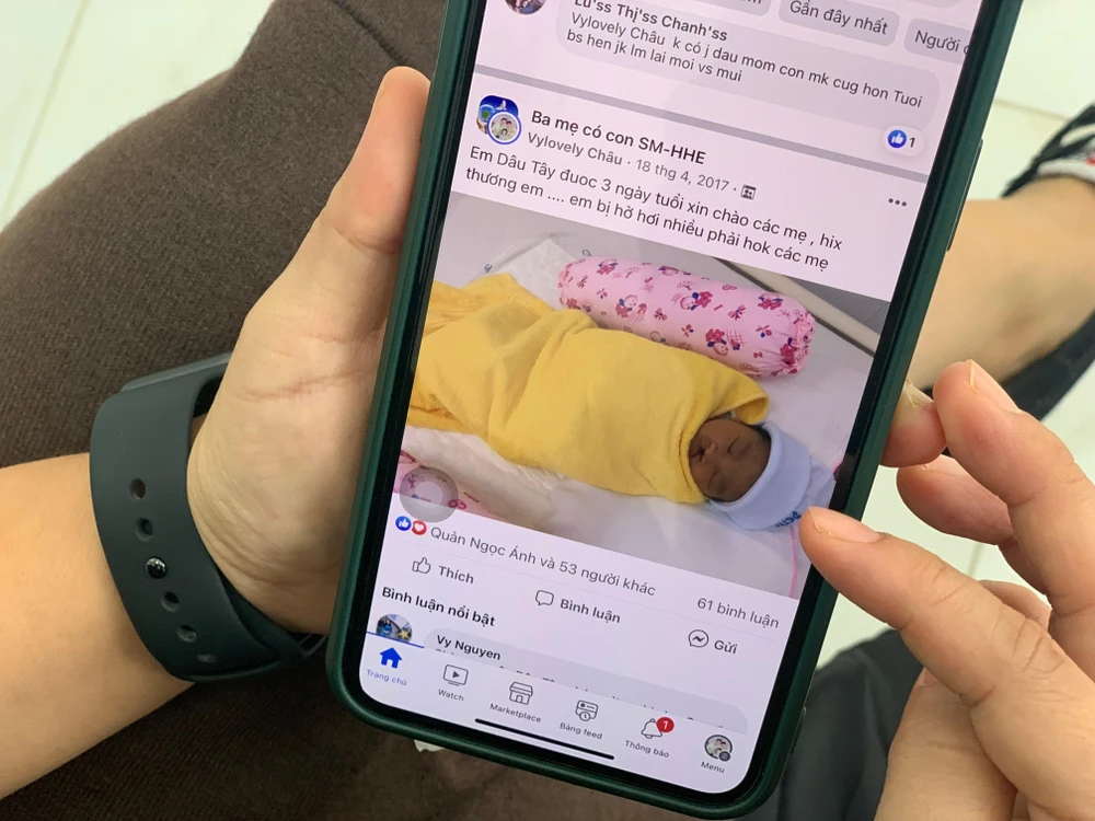 Tình trạng hở khe vòm của bé Dâu Tây lúc mới sinh ra. Ảnh: HL