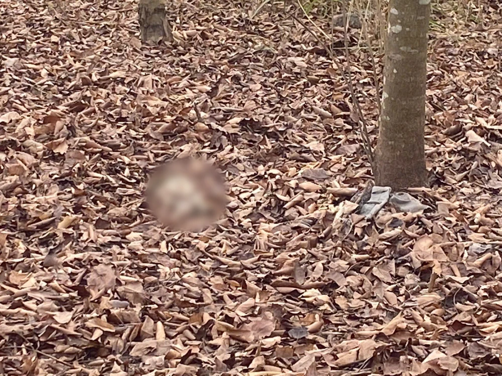 Bộ xương người