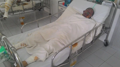 Thanh niên tạt xăng đốt cả bản thân để giải quyết mâu thuẫn ảnh 1