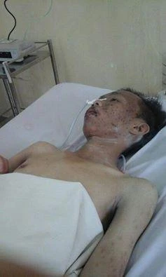 Hình ảnh mạng sống mong manh của Pháp trong phòng cách ly