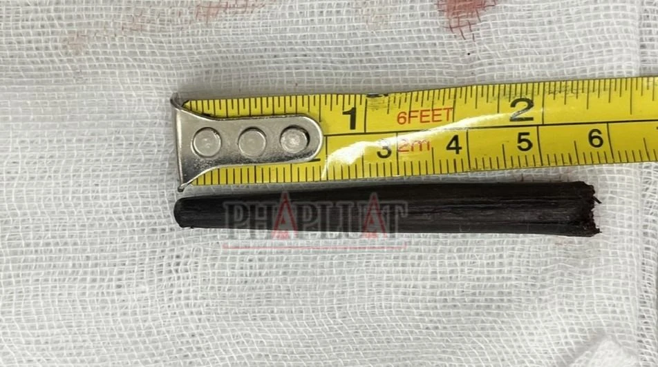 chiếc đũa trong hốc mắt (1).jpg