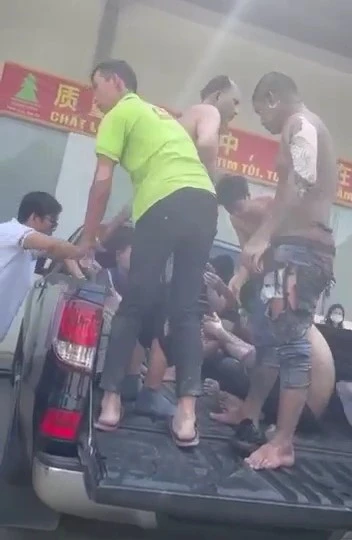 công nhân bị bỏng (1).jpg