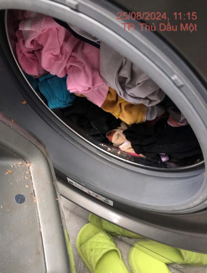 đứt lìa cánh tay (2).jpg