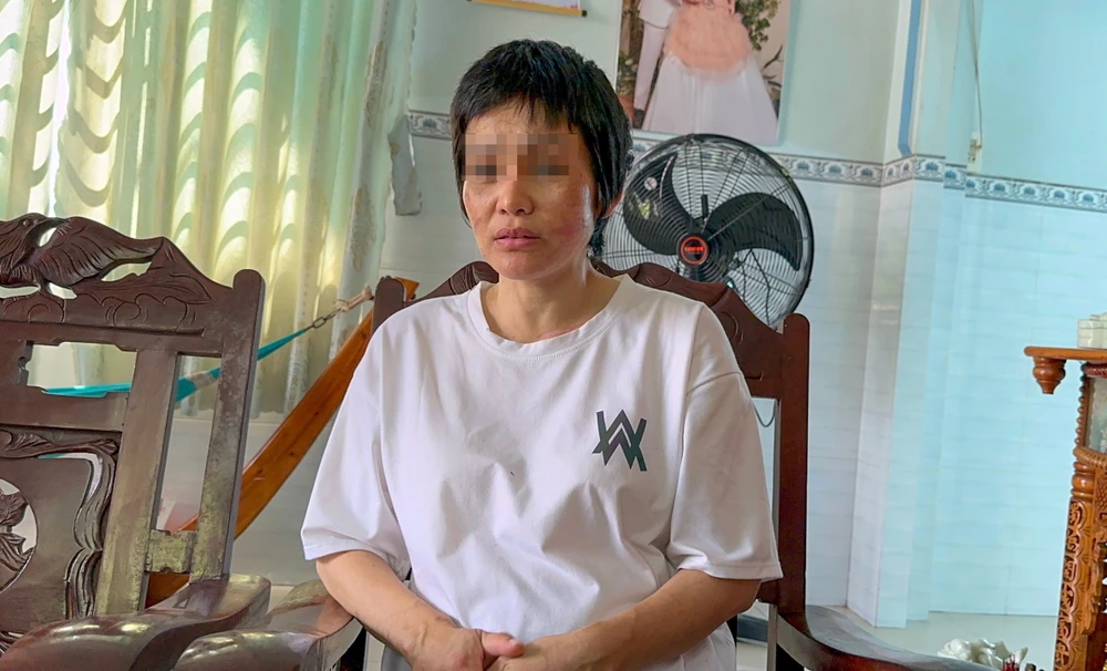 Chị G kể lại sự việc bị chồng bạo hành. Ảnh: AH.